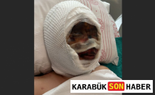 Gaziantep'te Eski Eş Dehşeti: Genç Kadın Yaşam Savaşı Veriyor