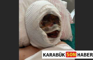 Gaziantep'te Eski Eş Dehşeti: Genç Kadın...